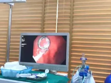 Bé trai 27 tháng tuổi nhập viện vì nuốt phải móc khóa