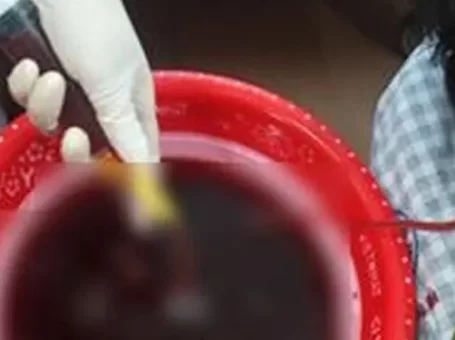 Người đàn ông ở Phú Thọ nôn ra 1 lít máu vì thường xuyên uống rượu