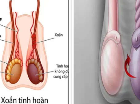 Phú Thọ: Nam thanh niên hỏng “của quý” do đến viện muộn