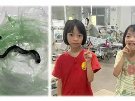 Hai bé gái bị rắn cắn đã có thể ra viện sau thời gian ngắn điều trị